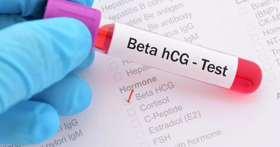 Beta HCG Testi Nedir? Gebe Olduğunuzu Kesin Gösterir Mi? kapak resmi